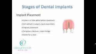 Stages Of Dental Implant Treatment At an Edinburgh Dentist