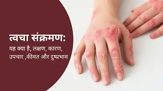 त्वचा संक्रमण क्या है? | Skin Infection Symptoms, Causes, Treatment, Cost & Side Effects