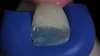 Ivoclar IPS Empress Direct – For highly aesthetic restorations