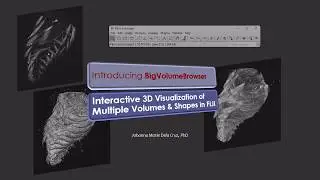 Interactive 3D Visualization of Multiple Volumes & Shapes in FIJI (BigVolumeBrowser)