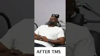 Before And After TMS Therapy - Military Vet