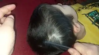 ASMR ✨️ SCALP NITPICKING w/gloves (no talking) Scalp check & detangling