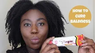 Virgin Hair fertilizer for hair growth, Growing my balding hair line