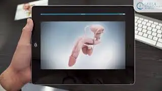 Shockwave Therapy for Erectile Dysfunction (ed) animation Process | How its work