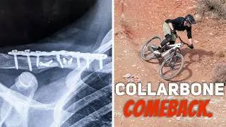 The Hard Reality Of Coming Back From An MTB Injury.