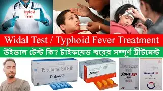 Typhoid Fever Treatment | Widal Test | Enteric Fever | Bong Pharma