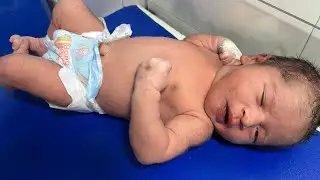 From Struggle to Stability 🌸 | Newborn MSL Baby After Treatment&rdquo;