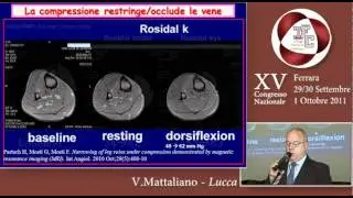 La terapia compressiva - V.MATTALIANO (CIF 2011)