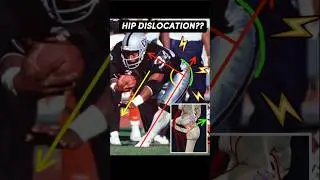 Перелом и вывих бедра у Бо Джексона | Объяснения врачей! #Raiders #Анатомия