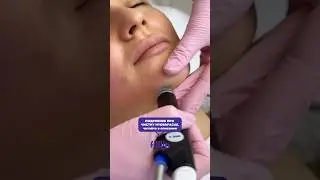 Чистка лица Hydrafacial от 4280₽ на Filllin.ru ✅ #косметология #чистка #hydrafacial #уходзакожей
