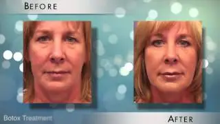 What Are The Most Common Procedures Before The Holidays?