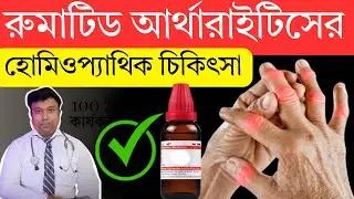 Rheumatoid Arthritis Treatment:রিউমাটয়েড আর্থারাইটিসের হোমিওপ্যাথিক চিকিৎসা @SantanuHomeoCare