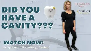 SOS! I HAVE A CAVITY?! | THE INVISALIGN GODDESS | INVISALIGN NORTHERN VIRGINIA