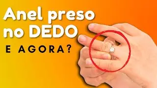 ANEL PRESO NO DEDO - 3 Maneiras de Tirar o Anel do Dedo