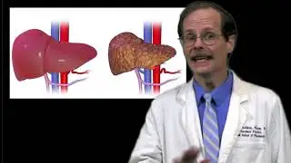 Methotrexate - Adverse Effects and Monitoring