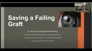 Cornea - To The Wonderland-saving the failing graft- Dr Nancy Al Raqqad