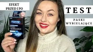 WYBIELANIE ZĘBÓW TEST▫️5 - DNIOWY▫️ PASKI WYBIELAJĄCE▫️ EFEKT PRZED I PO [OnTheLineWithAlex]