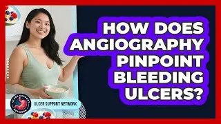 How Does Angiography Pinpoint Bleeding Ulcers? - Ulcer Support Network