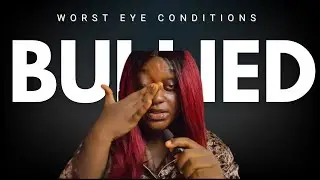 I have the Worst Eye Condition …Getting Bullied 