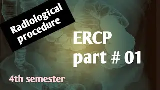 #endoscopic retrograde cholangiopancreatography/ERCP/part#01/Indications/procedure