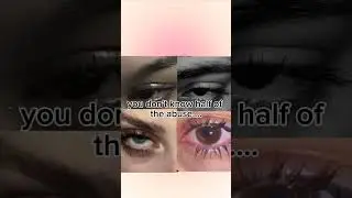 doe eyes.....#doeeyes #deadeyes