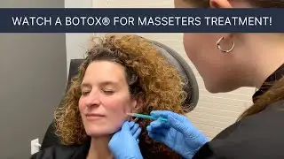 Save your teeth and stop grinding&mdash; Botox&reg; for masseters!