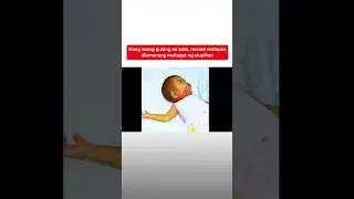 Isang taong gulang na bata, nasawi matapos diumanong makagat ng alupihan | Kapuso Mo, Jessica Soho