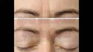 Face reading (Lines on The fore head part .)