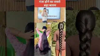 Vedant Sir&rsquo;s DIY Dandruff Cure 🌿 | Long & Healthy Hair Growth Remedy! #shorts #haircare#ytshorts