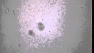 Esame coprologico di un cane infestato da Ancilostomi e Coccidi