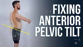 Why Core & Glute Exercises Aren't Fixing Your Anterior Pelvic Tilt Posture