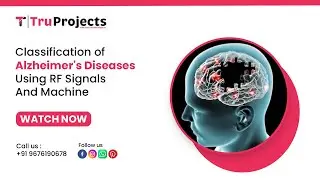 Classification of Alzheimer's diseases using RF signals and machine