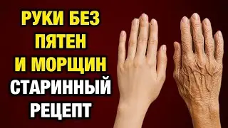 54 Руки моложе на 10 лет за неделю! Старинный рецепт, который всё ещё работает!