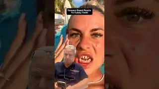 Veneers Expert Reacts To Turkey Teeth 👀🦷🇹🇷 #veneers #turkeyteeth #dentist #harleystreet