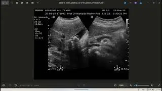 Record 2025 04 28 Prof Dr Hamada Khater BEST ULTRASOUND AND DOPPLER CASES