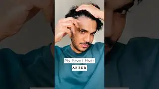 😱NEW BABY HAIR🔥this Actually Works🥹 #haircaresecrets #newhairgrowth #hairgrowthtips