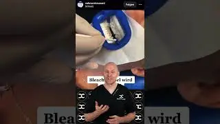 Ultrawei&szlig;e Z&auml;hne mit Philips Zoom Bleaching #reaction