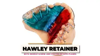 Hawley Retainer with Middle Screw