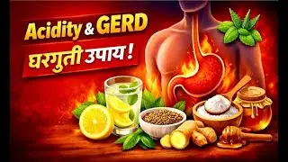 Acidity & GERD Home Remedies | Hyperacidity Ayurvedic Treatment  Acidity & GERD Home Remedies