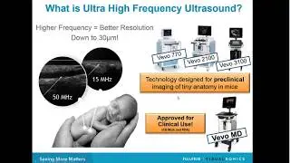June 2016 Webinar: Benefits of Ultra High Frequency Ultrasound for Children with Chronic Diseases