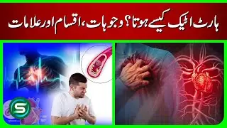 Heart Attack Explained: Causes, Types & Warning Signs You Must Know