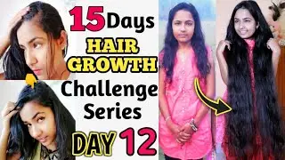 DAY 12 : 15 Days Hair Growth Challenge Series With Proof | Super Fast Hair Growth Pack | RuntiMe