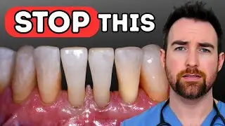 Bone Loss: The silent killer of teeth 