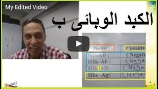 الكبد الوبائى ب - رد على سؤال أحد الحبايب