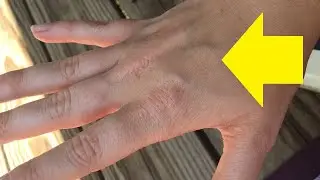 how to get rid of hand wrinkles easy exercise