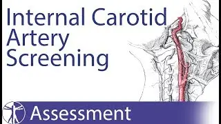 Carotid Artery Insufficiency | Pre-Manipulative Screening