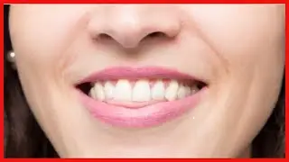 Was ist ein offener Biss und wie wird er korrigiert?