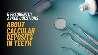 5 Frequently Asked Questions About Calcular Deposits in Teeth | Dental House MI