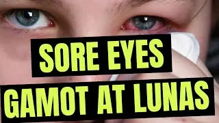 🥹 SORE EYES Gamot at Lunas + Paano mawala ang PAMUMULA ng MATA Home Remedies | Conjunctivitis