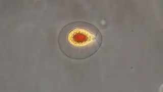 Haematococcus pluvialis, the green algae that turn red.
